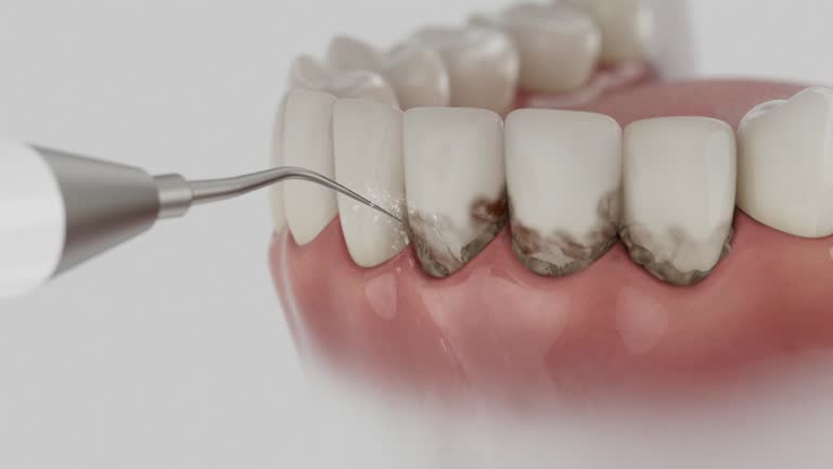 Reliable Wisdom Tooth Removal contractor in Garrett County County, MD by Dentist Open Now